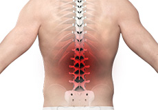 Back Pain