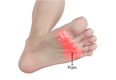 Forefoot Pain