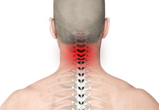 Neck Pain